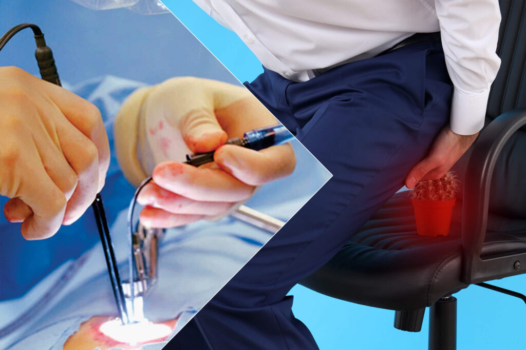 Safe procedures for hemorrhoid treatment with laser in Mashhad